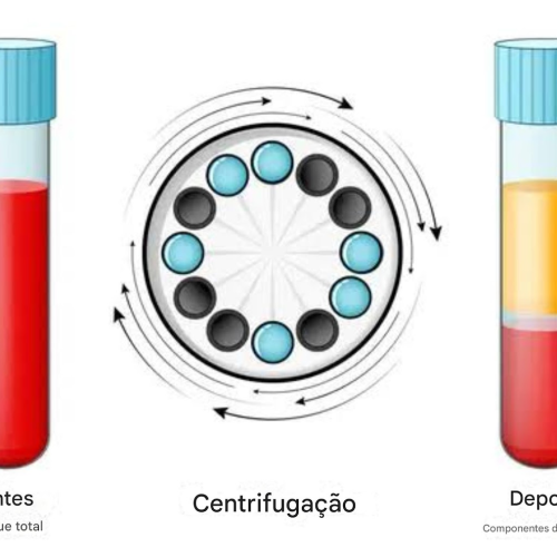 Infográfico do princípio da centrifugação mostrando a separação de amostras em pellet e sobrenadante.